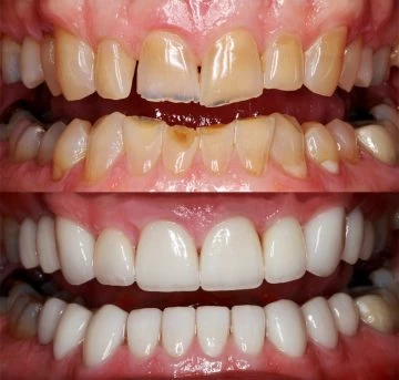 783_Scott_BAT-1
