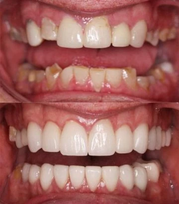 Harlan_BAT