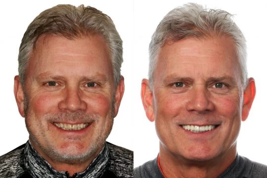 Steve BAF 3 1