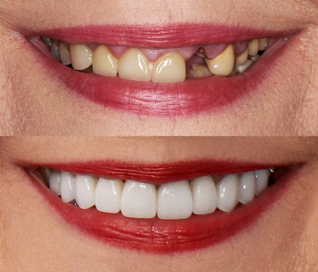 Restorative dentistry