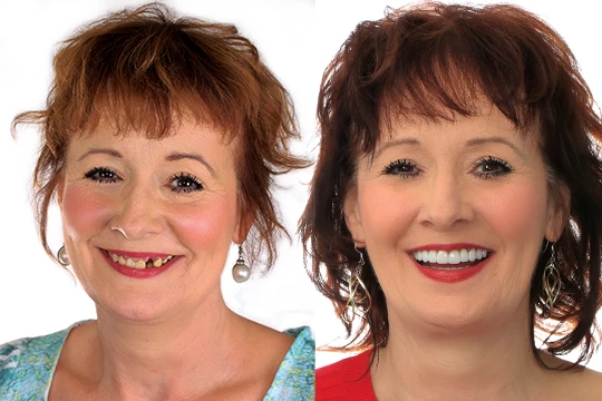brenda-BAF-web
