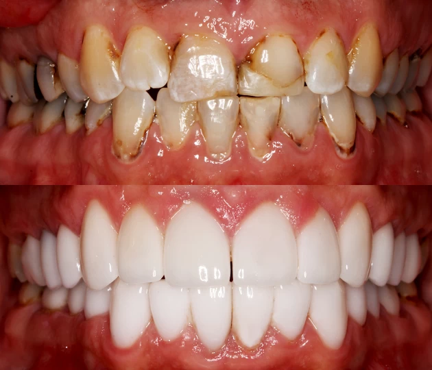 Christine H BAT Tobacco Effects on Teeth Wausau
