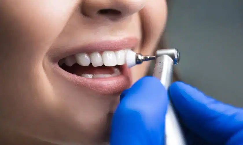 Dental Cleaning2 Family Dentistry Wausau