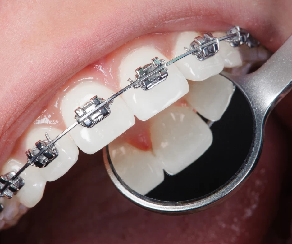 orthodontics2 dental-services