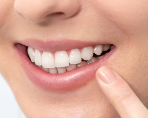 Restorative Dentistry Wausau Dentist