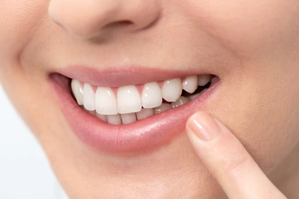 Fluoride Treatment 1 Fluoride Treatment Wausau