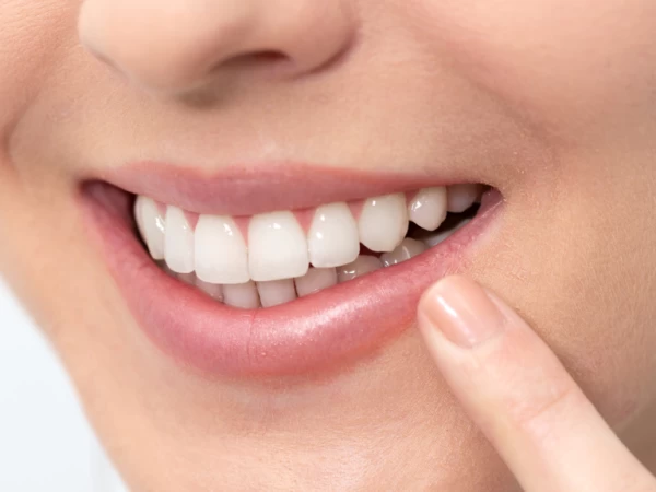 Services 3 dental-services