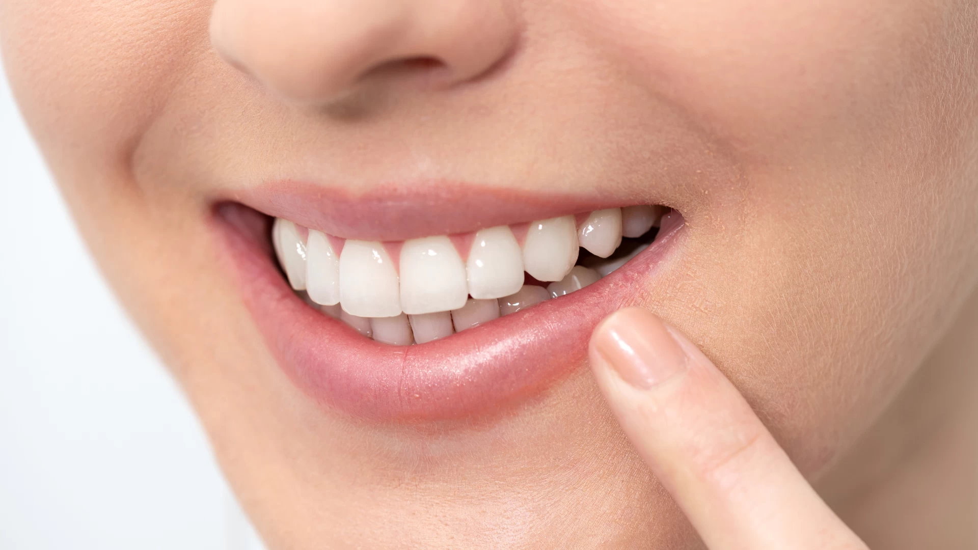 Dentures & Partials 1 Fluoride Treatment Process