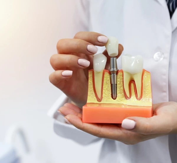 Services 2 dental-services